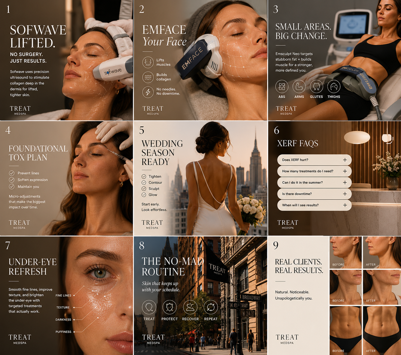 Nine-square Instagram grid for TREAT Medspa in NoMad, New York — warm bronze editorial photography with tiles for Sofwave lifting, Emface, Emsculpt Neo body contouring, a foundational Tox plan, wedding season prep, XERF FAQs, an under-eye refresh, the NoMad routine and real client before-and-afters